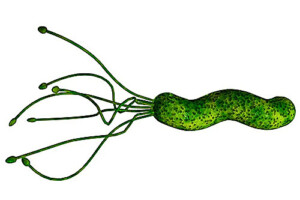 Urea breath test for helicobacter pylori